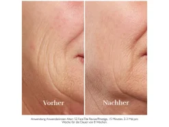 FaceTite Essentials antiverouderingsapparaat H2120/H2130<Silk´n Online