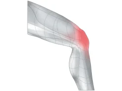 Kniegewrichtbandage<sensiplast® Best