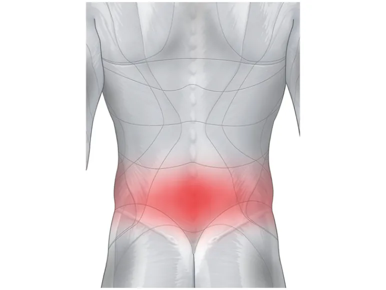 Rugbrace<sensiplast® Sale